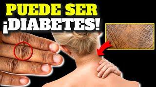 ALERT! FIRST ALARM SYMPTOMS of DIABETES| EARLY SYMPTOMS DIABETES AND PREDIABETES