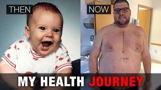 Tim's Health Journey - How did my weight affect my heart surgery?