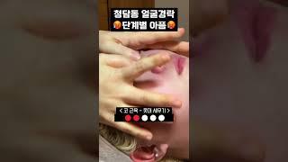 청담동  #얼굴경락 아픔정도 / 고통단계 