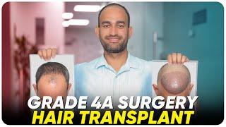 Hair Transplant in Ahmedabad | Best Results & Cost of Hair Transplant in Ahmedabad