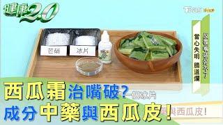 西瓜霜阿嬤都說好用 成分中藥與西瓜皮！ 健康2.0