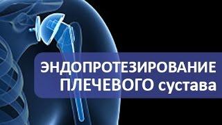 Эндопротезирование плечевого сустава. Операция эндопротезирования плечевого сустава.