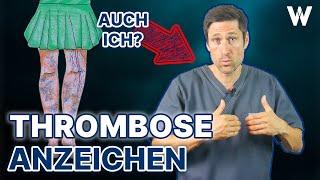 Thrombose: Plötzliche Anzeichen und Lebensgefahr! Typische Auslöser von Sitzen über Pille bis Corona