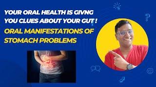 Dr Rudra Mohan | What your Oral Health is trying to tell you about your Gut Health| Peptic Disease