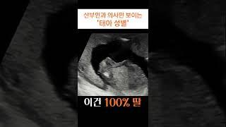 산부인과 의사는 초음파 사진만 보고 성별을 맞출 수 있을까?