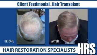 Hair Transplant Atlanta - Hair Restoration Specialists of Atlanta