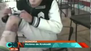 Vigilan al hombre adicto a la droga KROKODIL en Sonora/ Droga KROKODIL come la carne