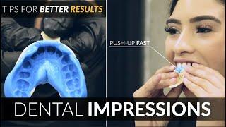 Dental Impression Tips for Cosmetic Dental Veneers w/ Snap On Smile Makeovers by Brighter Image Lab