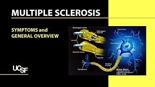 Multiple Sclerosis: Symptoms and General Overview