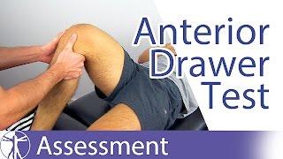 Anterior Drawer Test | Anterior Cruciate Ligament Rupture