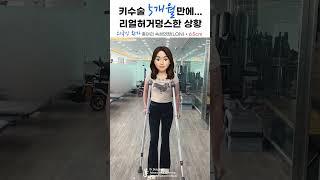 키수술로 6.5cm 종아리 연장한 외국인환자의 LON 2차 수술 3일 뒤 보행 재활 #키수술 #shorts #fyp #likejennie