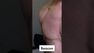 Beacon Chest Seal   оклюзійна пов'язка, яка точно не підведе Компанія Парамедик є офіційним предста
