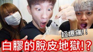 【小玉】超爆痛!白膠脫皮地獄!?【童年白膠脫皮遊戲】