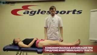 Кинезиотейпирование. Комбинированная аппликация при синдроме илиотибиального тракта