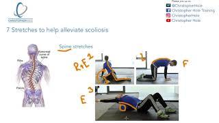 7 stretches to help alleviate scoliosis