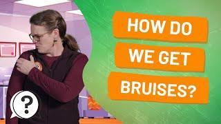 How do we get bruises? | But Why Bites