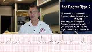 Atrioventricular Blocks EKG/ECG (ACLS Rhythm Strips) | Training Video