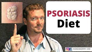 The Psoriasis Diet. Better than Medicine?? 2024