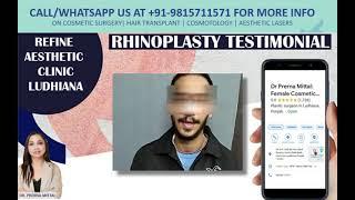 Best Rhinoplasty Surgeon in Punjab, Himachal, Patiala, Jalandhar - Dr. Prerna Mittal +91-9815711571