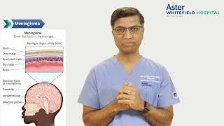 Meningioma | Prof. Dr. Satish Rudrappa | Aster Whitefield Hospital