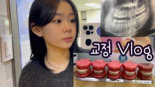 교정 Vlog | 교정하러 가는 날 #브이로그 #치아교정