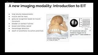 NeuroTechX Webinar#8-  Spectra: Open Source Biomedical Imaging Presented by Jean Rintoul