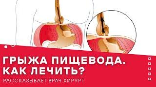 Грыжа пищевода. Как лечить?