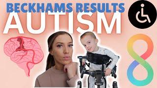 Beckham has officially been TESTED for AUTISM | His Results