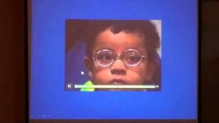 07  Congenital Esotropia Dr Dalal Shawky