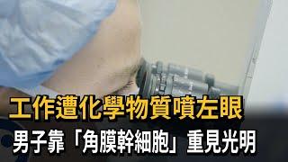 工作遭化學物質噴左眼　男子靠「角膜幹細胞」重見光明－民視新聞