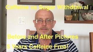 Quit Caffeine:  Caffeine vs Sugar Withdrawal - Five Years Caffeine Free!