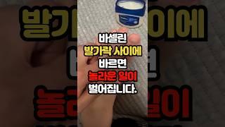 바셀린 발가락 사이에 바르면 놀라운 일이 벌어집니다. #백세시대 #건강 #중년건강 #일상건강 #중년 #바셀린 #혈점 #바셀린활용 #40대 #50대 #60대