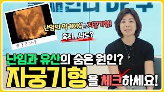 [둘째언니 Dr.구] 난임과 유산의 숨은 원인? 자궁기형을 체크하세요