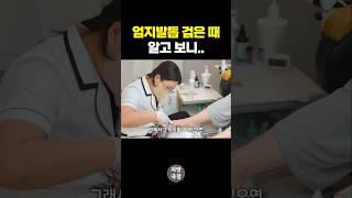 엄지발톱에 낀 때, 그냥 양말 찌꺼기라고 생각하셨나요?