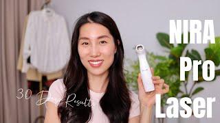 I tried a painless laser treatment | NIRA Pro review & 30-day update | Chris Han