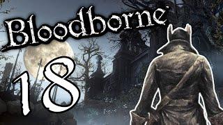 Well That's Embarrassing | Bloodborne P.18