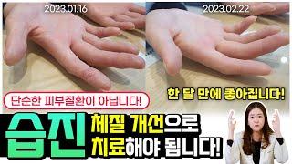 습진! 몸이 보내는 적신호! 외부의 문제가 아닌 체내의 문제로 생길 수 있습니다!  [ 위례해오름한의원 ]