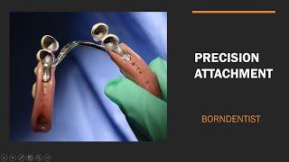 PRECISION ATTACHMENT IN RPD