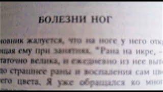 38.  Болезни ног.  Язвы и нарывы.