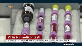 Virüs için antikor testi