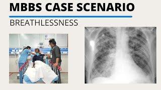 MBBS Case Scenario || Acute Breathlessness || Acute Dyspnea