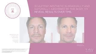 About Sculptra Aesthetic at Dr. Pacholec Wellness & Weight Loss