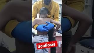 scoliosis treatment by Indian chiropractor Dr.Rajneesh kant 9308511357,8409313131