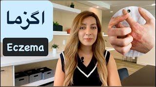 اگزما( از علت تا درمان)/Eczema/Atopic Dermatitis