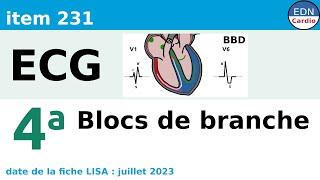 231 - Electrocardiogramme (ECG) - Partie 4a - Les blocs de branche (BBD, BBG, BFPG, BFAG)