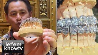 Kevin Gates New 28 Teeth Flawless Carré Cut Permanent Diamond Grill Explained By Johnny Dang