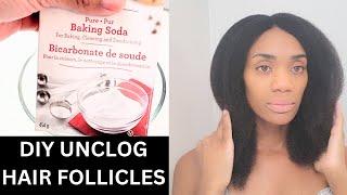 DIY Unclogging Hair Follicles - Unleash Your Growth