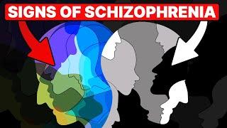 Schizophrenia WARNING Signs: Do You Have These Symptoms?