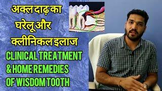 अक्ल दाढ़ के इलाज और घरेलू उपाय.. Wisdom tooth treatment and Home Remedies..