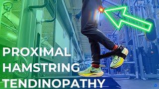 How I BEAT Proximal Hamstring Tendinopathy: Runner's Story